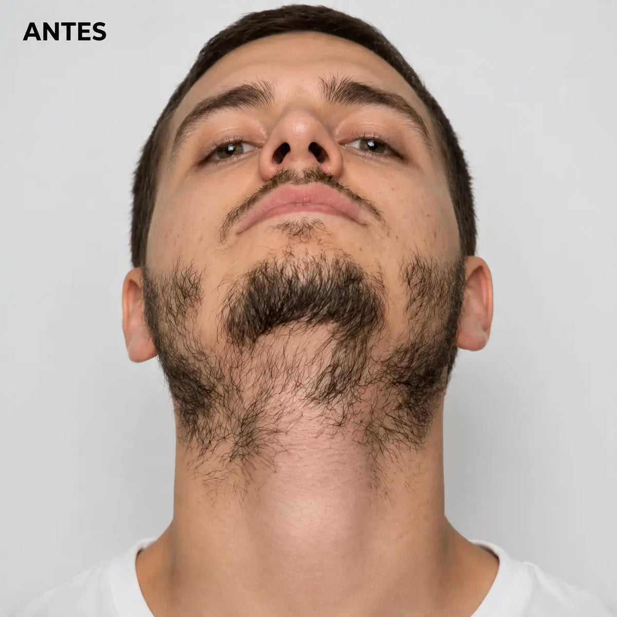 Antes